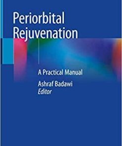 Periorbital Rejuvenation: A Practical Manual 1st ed. 2020 Edition