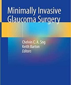 Minimally Invasive Glaucoma Surgery 1st ed. 2021 Edition