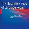 The Illustrative Book of Cartilage Repair 1st ed. 2021 Edition