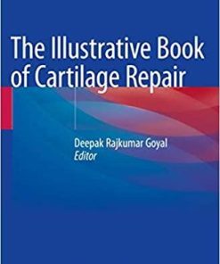 The Illustrative Book of Cartilage Repair 1st ed. 2021 Edition