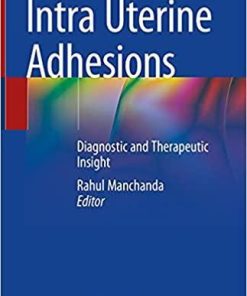 Intra Uterine Adhesions: Diagnostic and Therapeutic Insight 1st ed. 2021 Edition