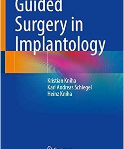 Guided Surgery in Implantology 1st ed. 2021 Edition