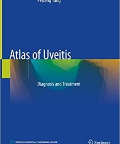 Atlas of Uveitis: Diagnosis and Treatment 1st ed. 2021 Edition