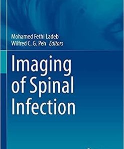 Imaging of Spinal Infection (Medical Radiology) 1st ed. 2021 Edition