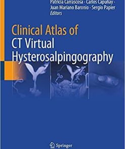 Clinical Atlas of CT Virtual Hysterosalpingography 1st ed. 2021 Edition