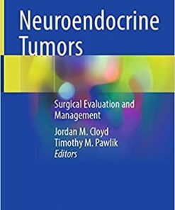 Neuroendocrine Tumors: Surgical Evaluation and Management 1st ed. 2021 Edition