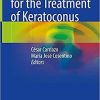 New Frontiers for the Treatment of Keratoconus 1st ed. 2021 Edition