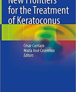 New Frontiers for the Treatment of Keratoconus 1st ed. 2021 Edition