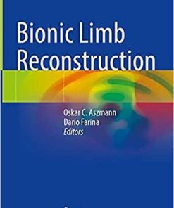 Bionic Limb Reconstruction 1st ed. 2021 Edition