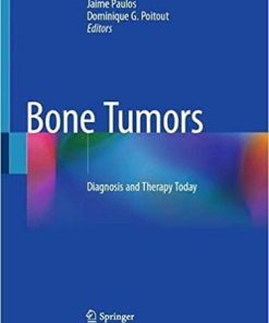 Bone Tumors: Diagnosis and Therapy Today 1st ed. 2021 Edition