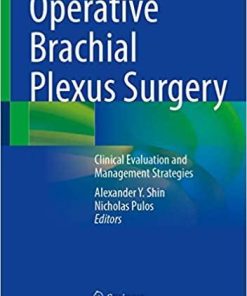 Operative Brachial Plexus Surgery: Clinical Evaluation and Management Strategies 1st ed. 2021 Edition