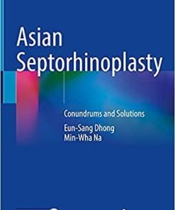 Asian Septorhinoplasty: Conundrums and Solutions 1st ed. 2021 Edition