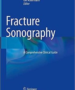 Fracture Sonography: A Comprehensive Clinical Guide 1st ed. 2021 Edition