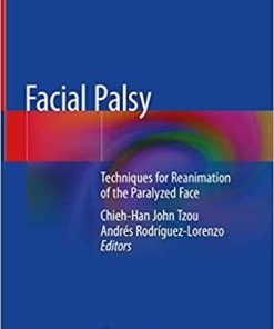 Facial Palsy: Techniques for Reanimation of the Paralyzed Face 1st ed. 2021 Edition