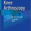 Knee Arthroscopy: An Up-to-Date Guide 1st ed. 2021 Edition