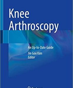 Knee Arthroscopy: An Up-to-Date Guide 1st ed. 2021 Edition