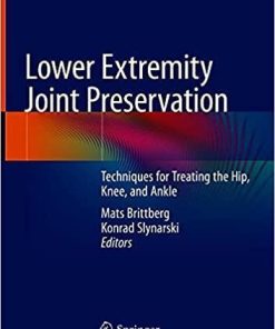 Lower Extremity Joint Preservation: Techniques for Treating the Hip, Knee, and Ankle 1st ed. 2021 Edition