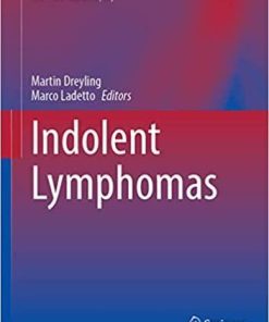 Indolent Lymphomas (Hematologic Malignancies) 1st ed. 2021 Edition