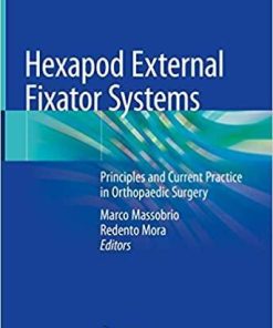 Hexapod External Fixator Systems: Principles and Current Practice in Orthopaedic Surgery 1st ed. 2021 Edition