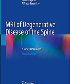 MRI of Degenerative Disease of the Spine: A Case-Based Atlas 2nd ed. 2021 Edition