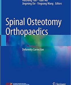 Spinal Osteotomy Orthopaedics: Deformity Correction 1st ed. 2021 Edition