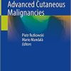 New Therapies in Advanced Cutaneous Malignancies 1st ed. 2021 Edition