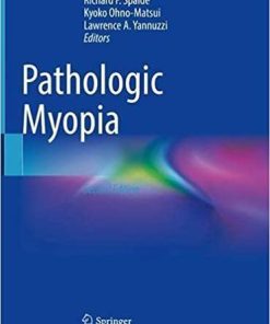 Pathologic Myopia 2nd ed. 2021 Edition
