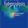 Essential Tuberculosis 1st ed. 2021 Edition