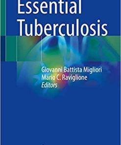 Essential Tuberculosis 1st ed. 2021 Edition
