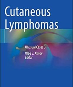 Cutaneous Lymphomas: Unusual Cases 3 1st ed. 2021 Edition