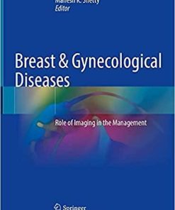 Breast & Gynecological Diseases: Role of Imaging in the Management 1st ed. 2021 Edition