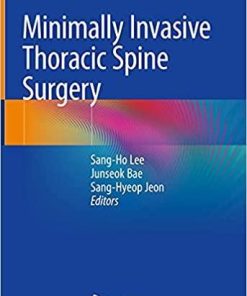 Minimally Invasive Thoracic Spine Surgery 1st ed. 2021 Edition