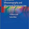 Ophthalmic Ultrasonography and Ultrasound Biomicroscopy: A Clinical Guide 1st ed. 2021 Edition