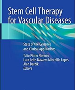 Stem Cell Therapy for Vascular Diseases: State of the Evidence and Clinical Applications 1st ed. 2021 Edition