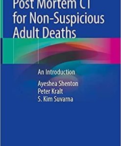 Post Mortem CT for Non-Suspicious Adult Deaths: An Introduction 1st ed. 2021 Edition
