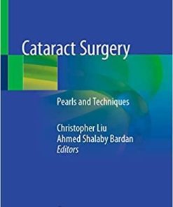 Cataract Surgery: Pearls and Techniques 1st ed. 2021 Edition