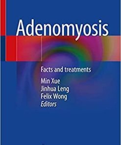 Adenomyosis: Facts and treatments 1st ed. 2021 Edition
