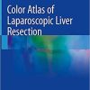 Color Atlas of Laparoscopic Liver Resection 1st ed. 2021 Edition Color Atlas of Laparoscopic Liver Resection 1st ed. 2021 Edition