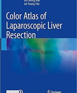 Color Atlas of Laparoscopic Liver Resection 1st ed. 2021 Edition