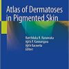 Atlas of Dermatoses in Pigmented Skin 1st ed. 2021 Edition Atlas of Dermatoses in Pigmented Skin 1st ed. 2021 Edition