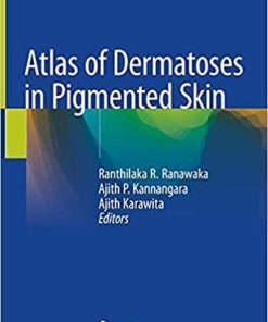 Atlas of Dermatoses in Pigmented Skin 1st ed. 2021 Edition