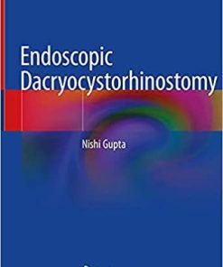 Endoscopic Dacryocystorhinostomy 1st ed. 2021 Edition