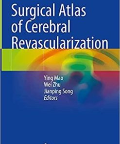 Surgical Atlas of Cerebral Revascularization 1st ed. 2021 Edition
