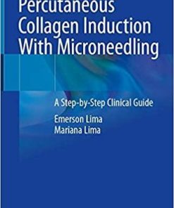 Percutaneous Collagen Induction With Microneedling: A Step-by-Step Clinical Guide 1st ed. 2021 Edition