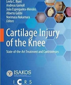 Cartilage Injury of the Knee: State-of-the-Art Treatment and Controversies 1st ed. 2021 Edition