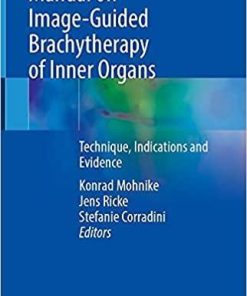 Manual on Image-Guided Brachytherapy of Inner Organs: Technique, Indications and Evidence 1st ed. 2021 Edition