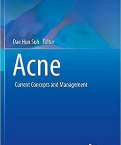 Acne: Current Concepts and Management (Updates in Clinical Dermatology) 1st ed. 2021 Edition