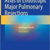 Atlas of Endoscopic Major Pulmonary Resections 3rd ed. 2021 Edition