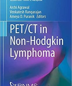PET/CT in Non-Hodgkin Lymphoma (Clinicians’ Guides to Radionuclide Hybrid Imaging) 1st ed. 2021 Edition