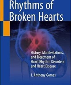 Rhythms of Broken Hearts: History, Manifestations, and Treatment of Heart Rhythm Disorders and Heart Disease 1st ed. 2021 Edition